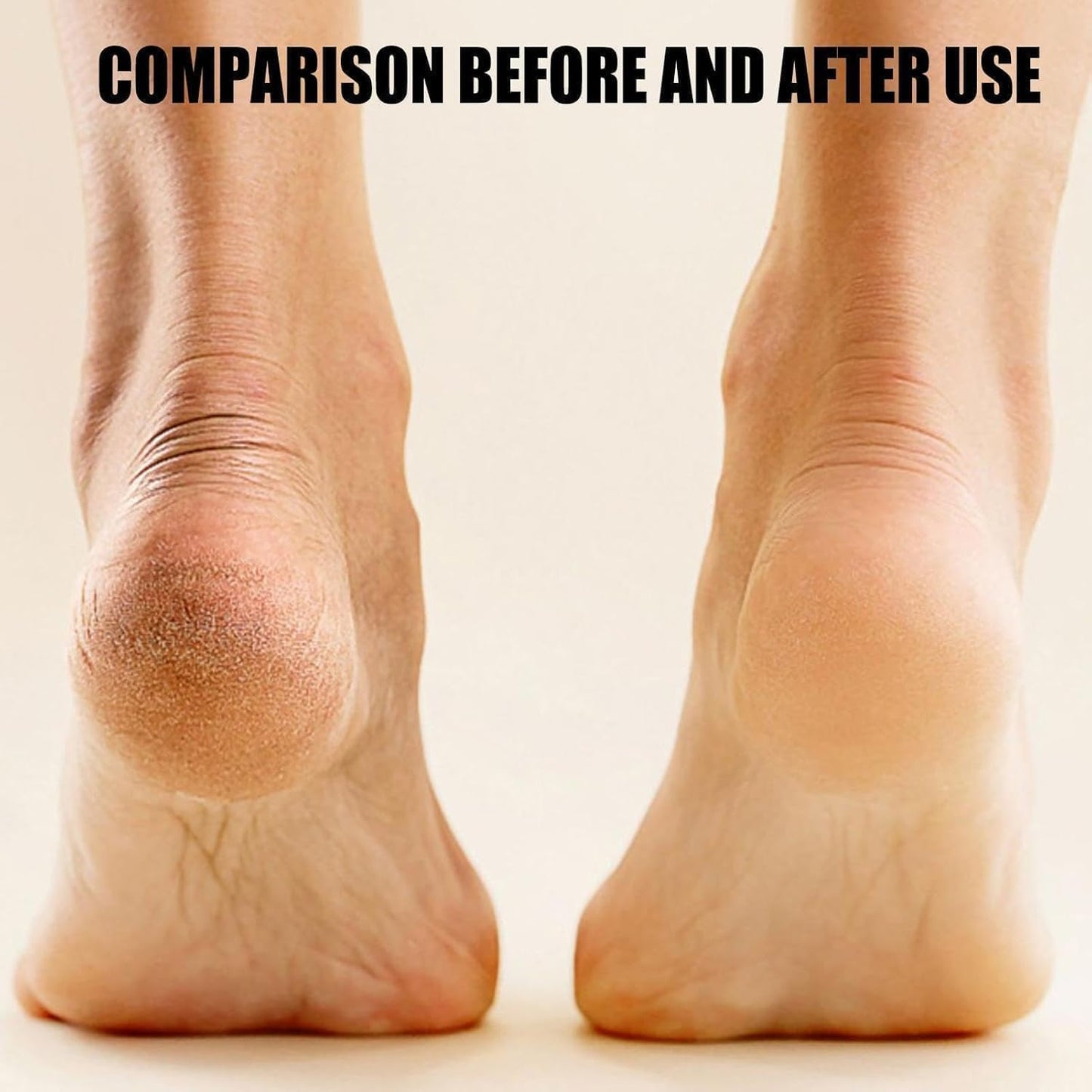 Electric Foot Callus & Dead Skin Remover