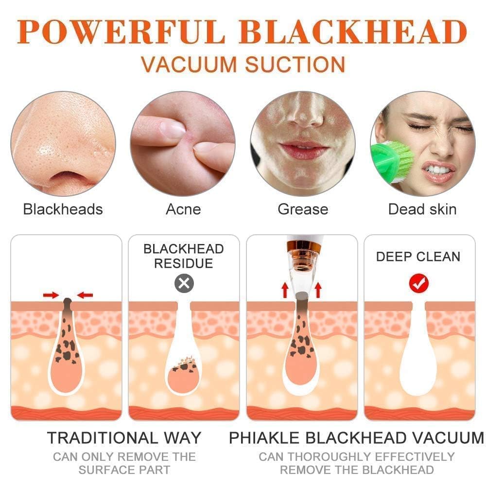 PoreExtract Pro | Multifunction Blackhead Remover Vacuum | 3-Speed Adjustable Mode Format | 6 Interchangeable Suction Heads
