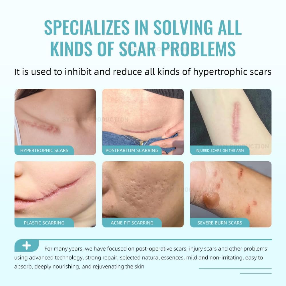 Advanced Scar Gel for Face & Body - Scar Reduction & Skin Renewal (50ml)