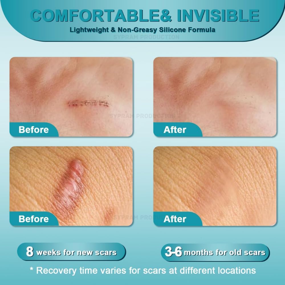 Advanced Scar Gel for Face & Body - Scar Reduction & Skin Renewal (50ml)